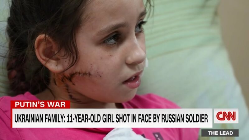 11-Year-Old Girl Shot In The Face By Russian Soldiers Now In Poland