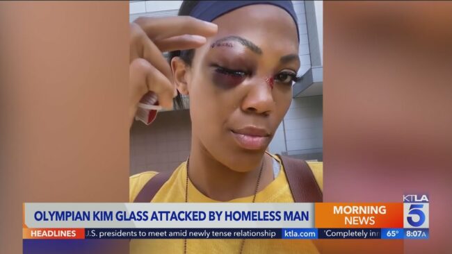 Former Olympic Volleyball Player, Kim Glass Brutally Assaulted By Homeless Man